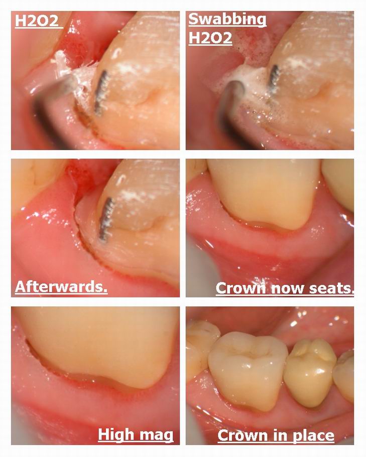 Resize of Seating Onlay pg 2.jpg